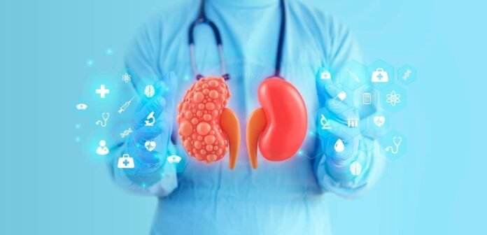 New Study Links Blood Inflammation Ratio to Higher Risk of Diabetic Kidney Disease